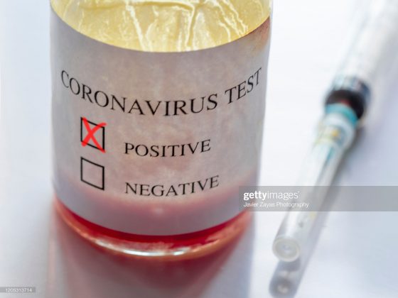 Coronavirus: proteção social dos trabalhadores é insuficiente